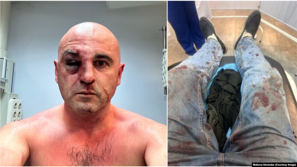 On April 30, 2024, on Rustaveli Avenue during a rally, a then-member of the Interior Ministry’s special operations unit - now head of a department in the State Security Service’s operational division - together with another officer, beat politician Levan Khabeishvili, breaking facial bones and knocking out his teeth.